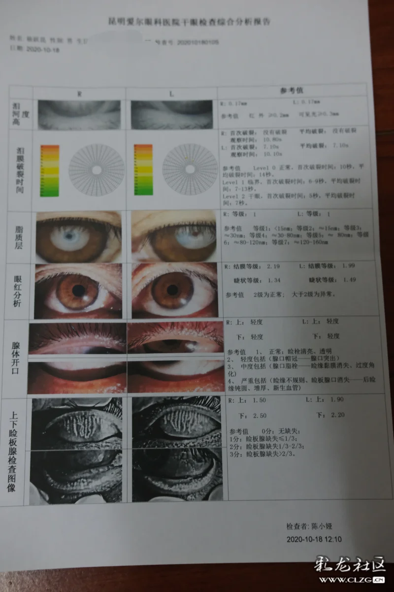 我的检查报告单干眼润目雾化治疗