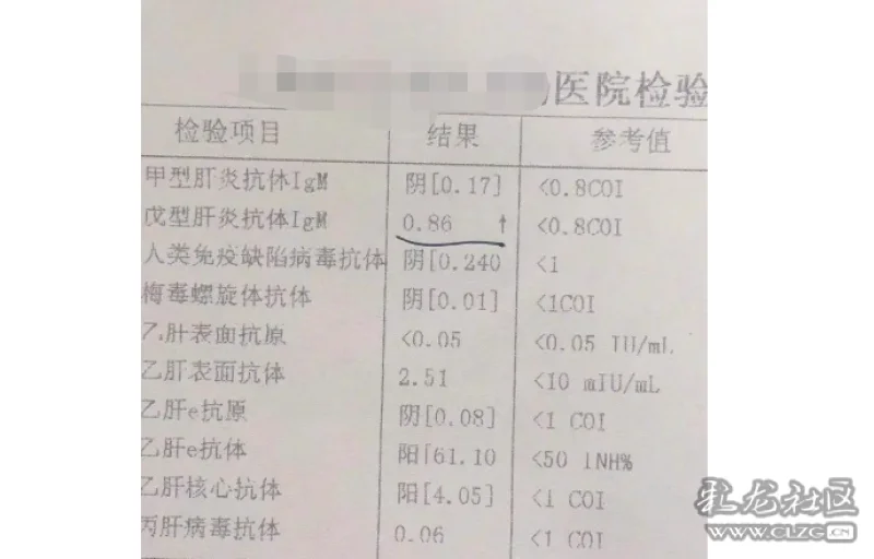 接种了甲肝乙肝丙肝疫苗没想到居然得了戊肝戊肝疫苗你陌生吗