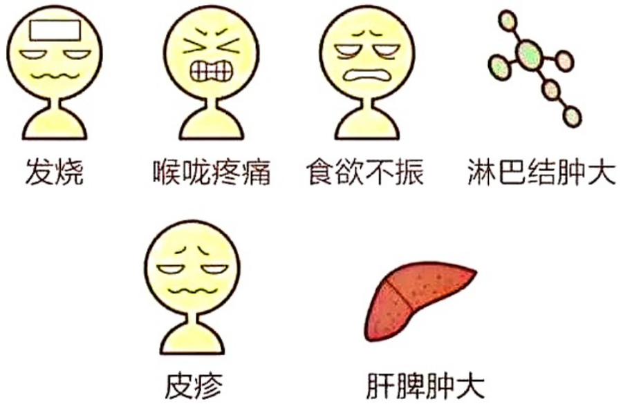 发热,咽痛,疲劳等全身症状;大多数eb病毒感染者在感染后并未出现明显